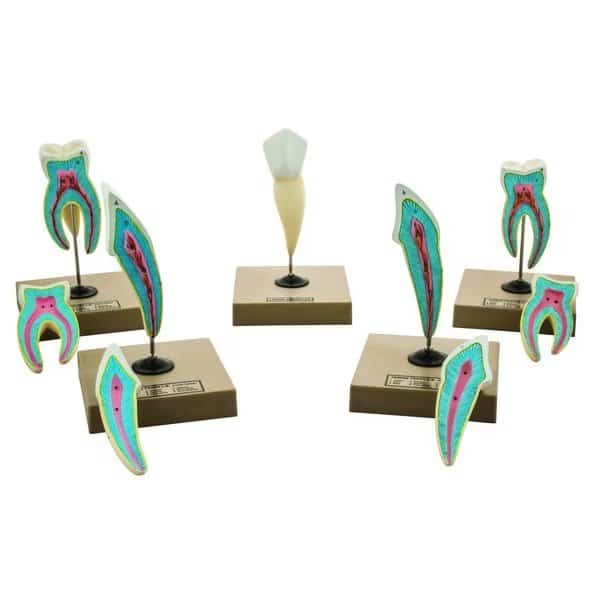 Eisco Labs Human Teeth Models - Set of 5 Different Models