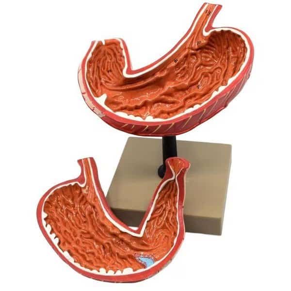 Human Stomach Model, 2 Parts, 3-D, Sectional View, Mounted, 5"x5"x7.5"